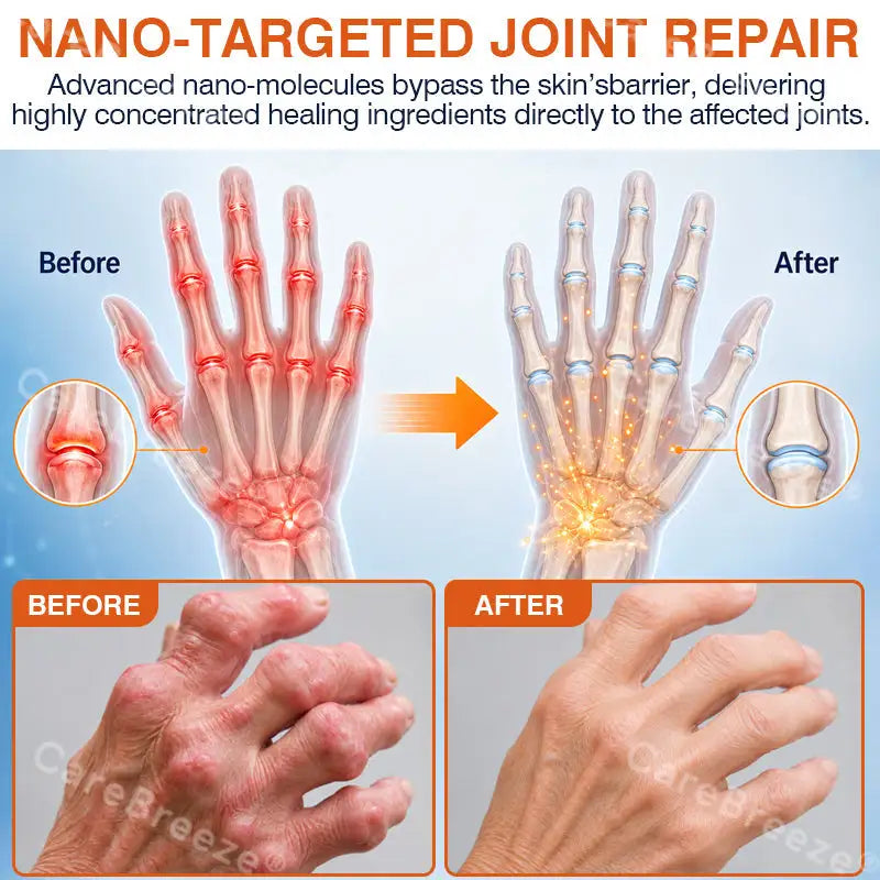 CareBreeze® Pain-Relief Bone-Healing Microneedle Patch
