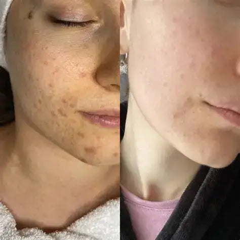 LOVILDSTM Water Light Anti-Aging Facial Cream